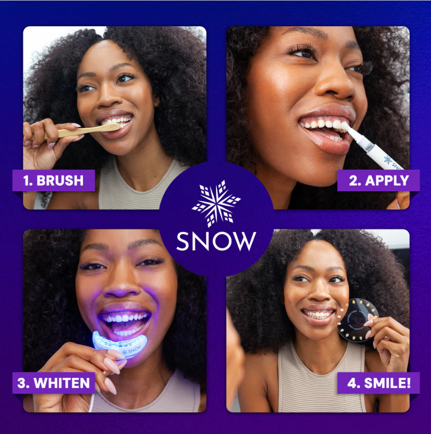 SNOW® Diamond Series Teeth Whitening Kit | Professional Whitening at Home (1 Serum) - Image 4