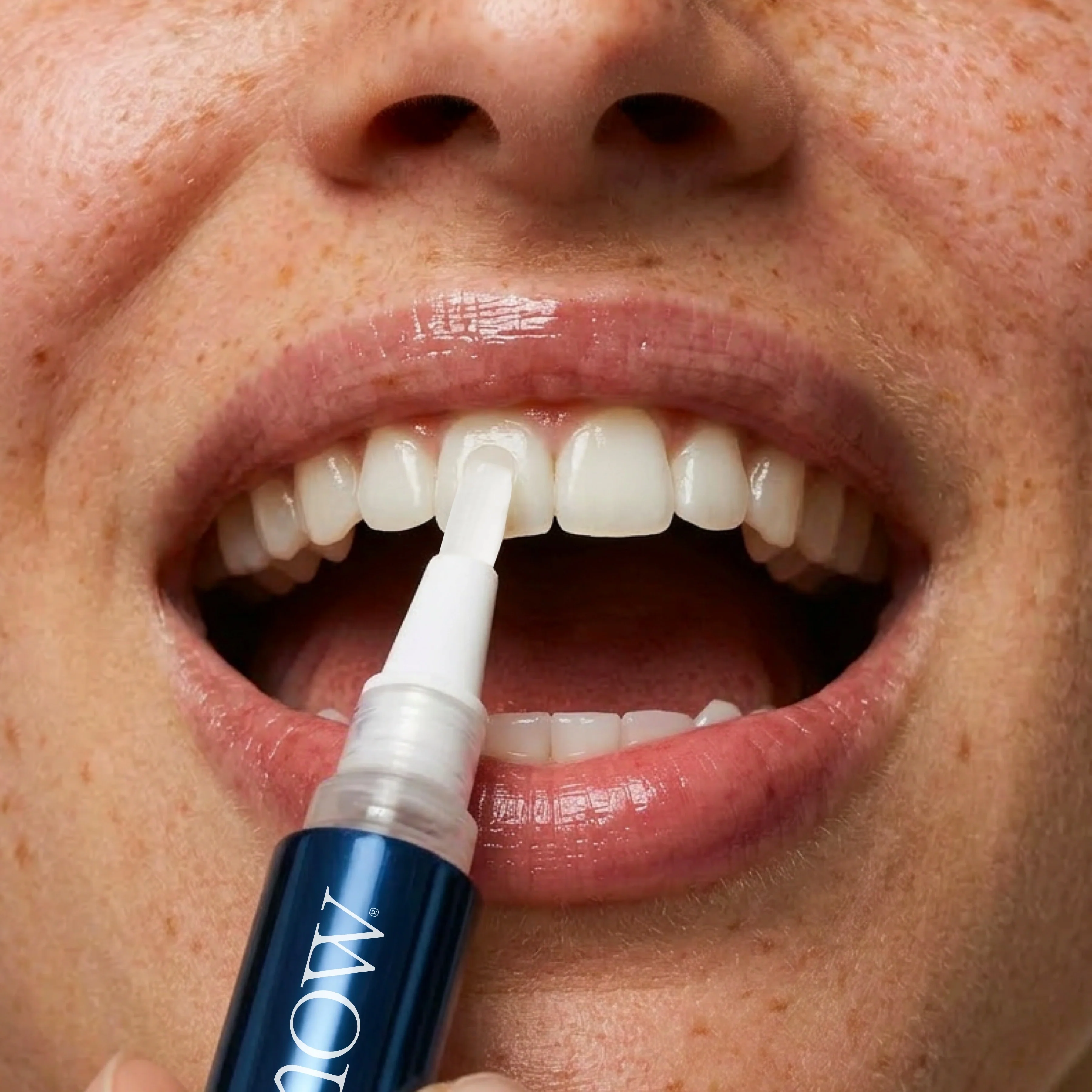Overnight Teeth Whitening Pen - Image 3