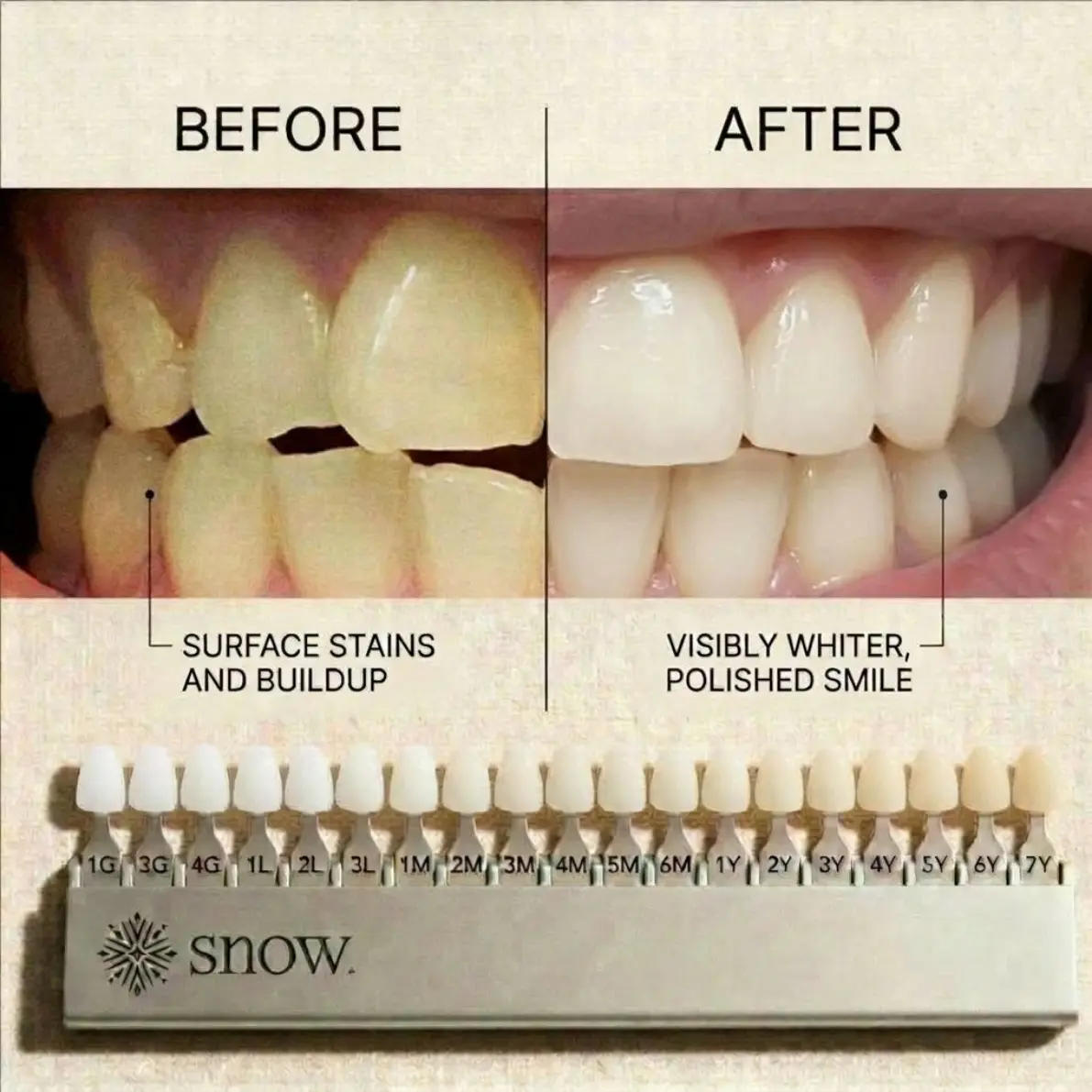 Teeth Whitening Powder - Image 8