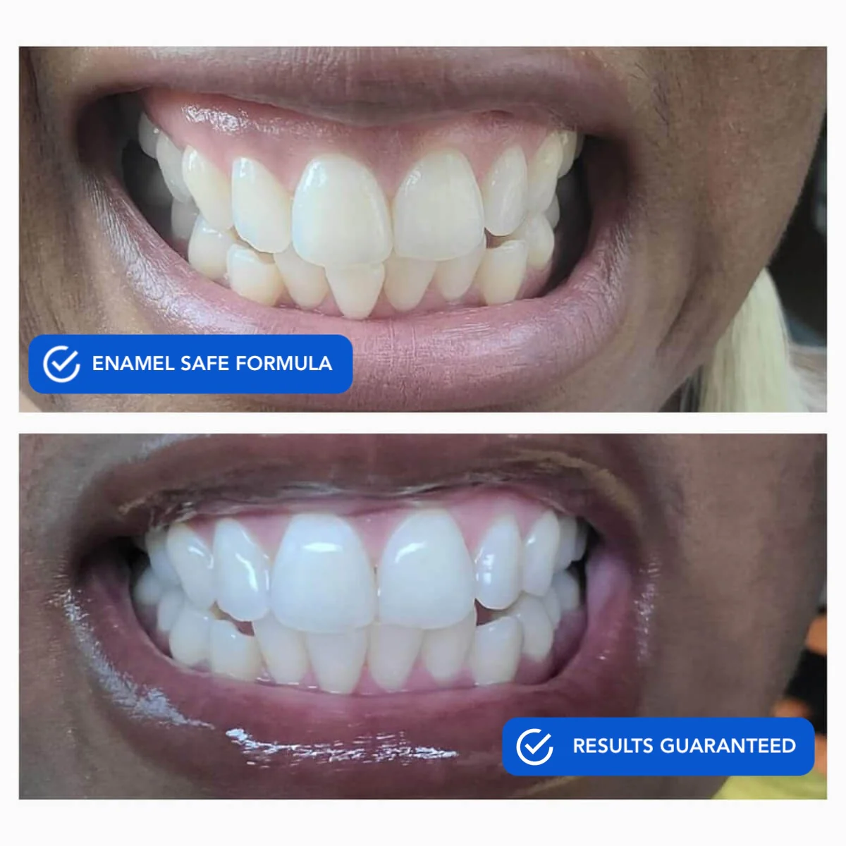 SNOW® DiamondSeries® | Dissolving Teeth Whitening Strips - Image 4